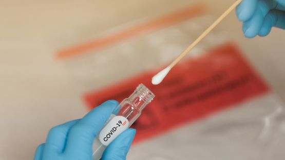Coronavirus (COVID-19) : des tests payants pour les non-résidents ?