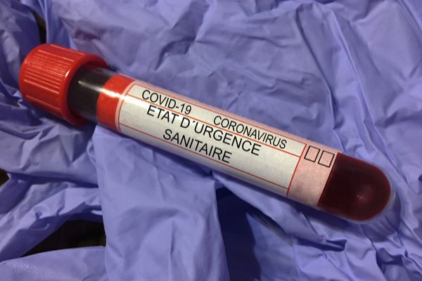 Coronavirus (COVID-19) : l’état d’urgence sanitaire est déclaré en Martinique et à La Réunion