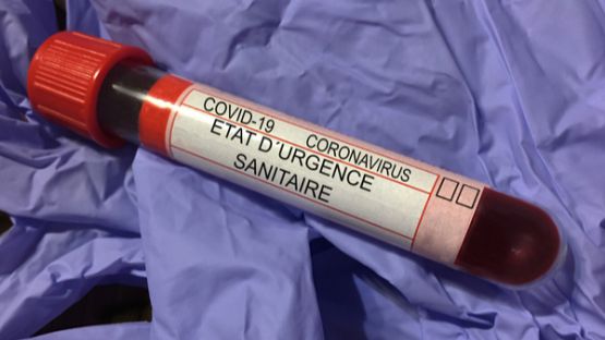 Coronavirus (COVID-19) : l’état d’urgence sanitaire est déclaré en Martinique et à La Réunion