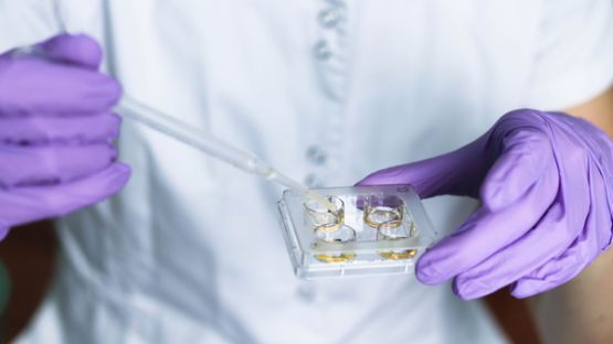 Loi bioéthique : ce qu’il faut savoir sur la recherche sur embryon