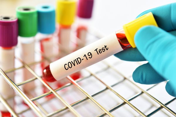 Coronavirus (COVID-19) : combien cela coûte de se faire tester en Outre-mer ?