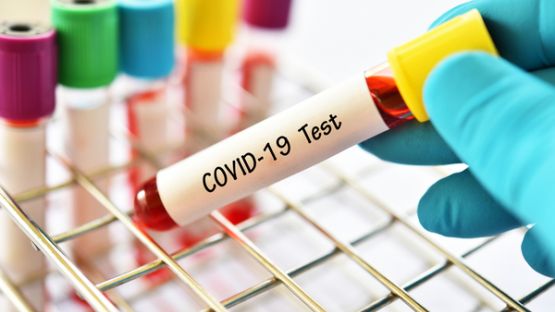 Coronavirus (COVID-19) : combien cela coûte de se faire tester en Outre-mer ?