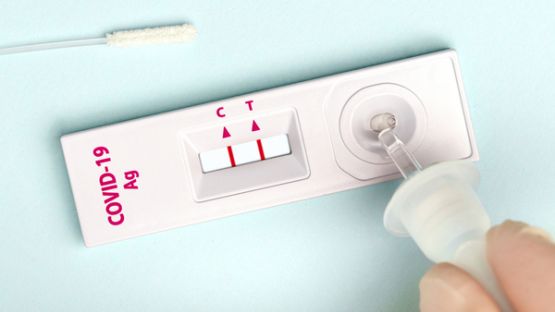 Coronavirus (COVID-19) et autotests : prolongation de l’autorisation de vente pour les grandes surfaces