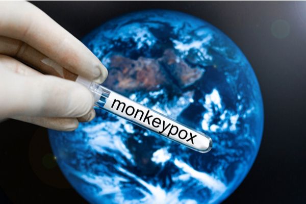Variole du singe (monkeypox) : mobilisation de la réserve sanitaire !